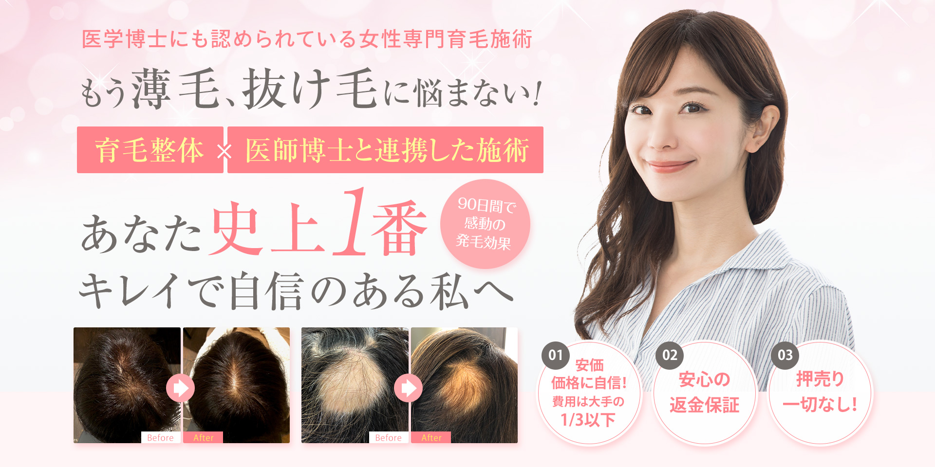 レディース発毛