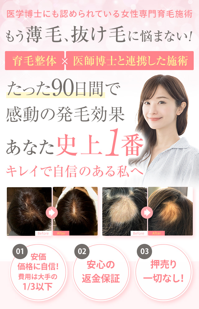 レディース発毛