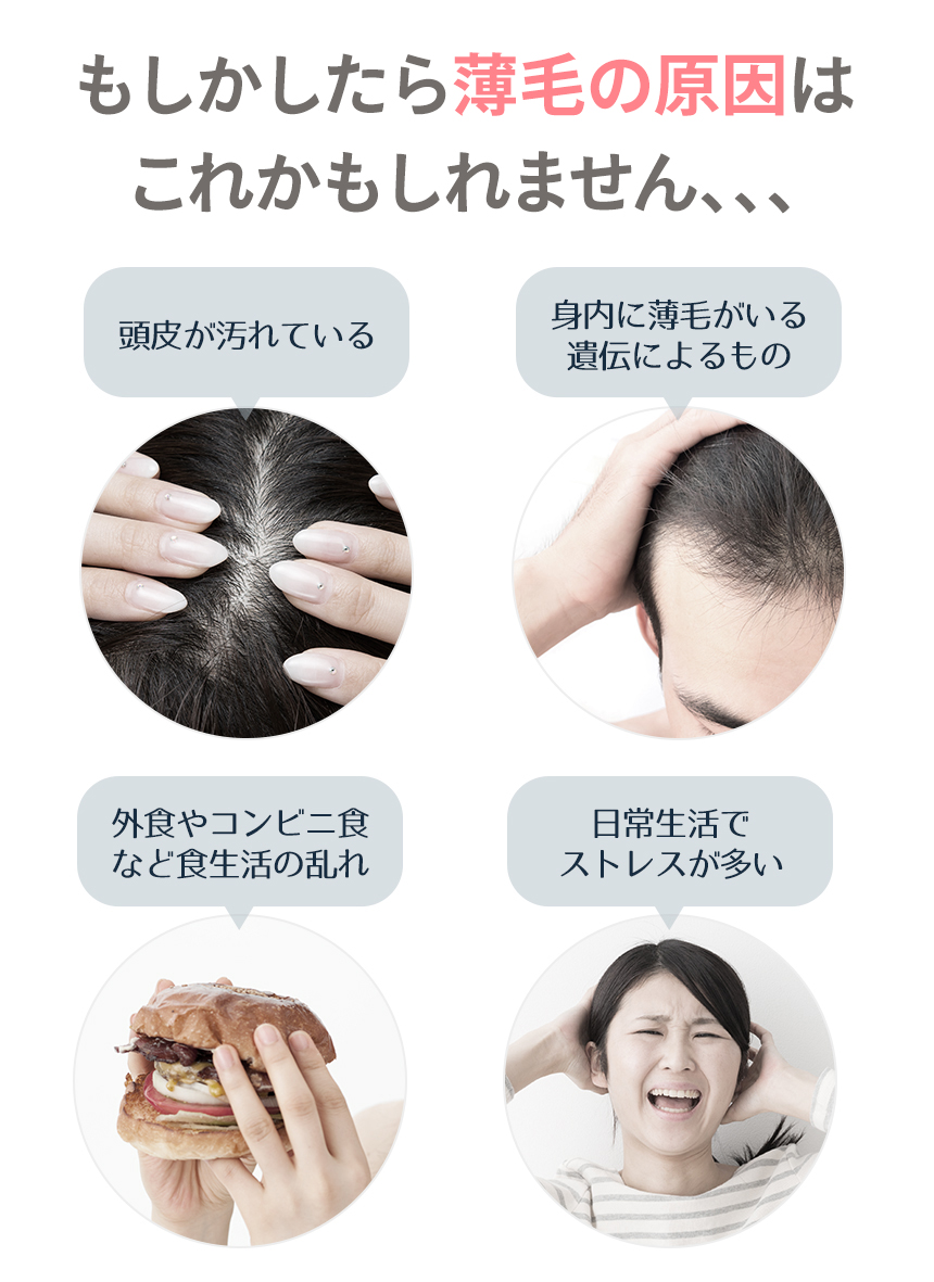 薄毛の原因