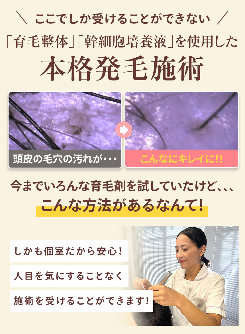 本格発毛施術