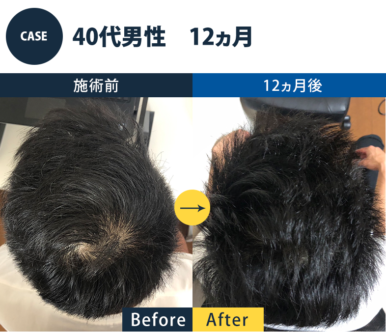 志免町育毛センター改善事例