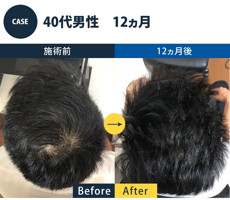 志免町育毛センター改善事例