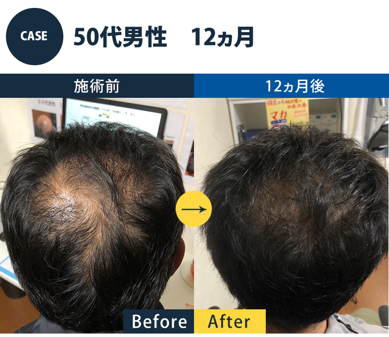 志免町育毛センター改善事例