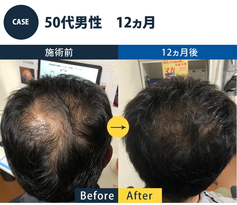 志免町育毛センター改善事例