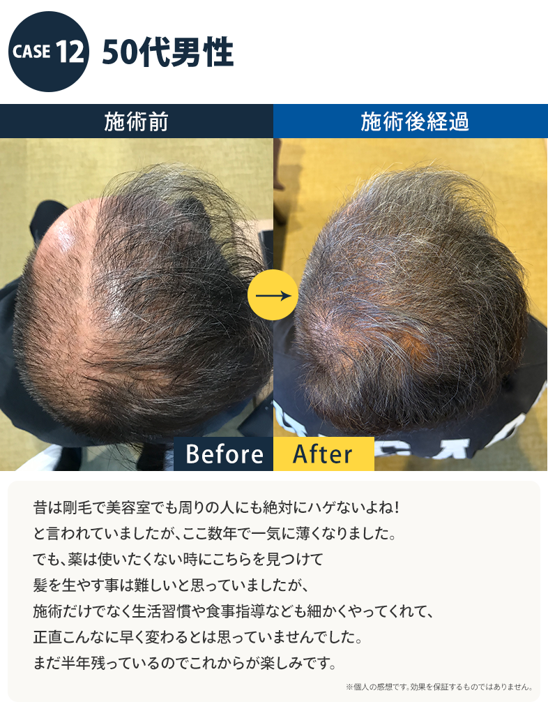 志免町育毛センター改善事例