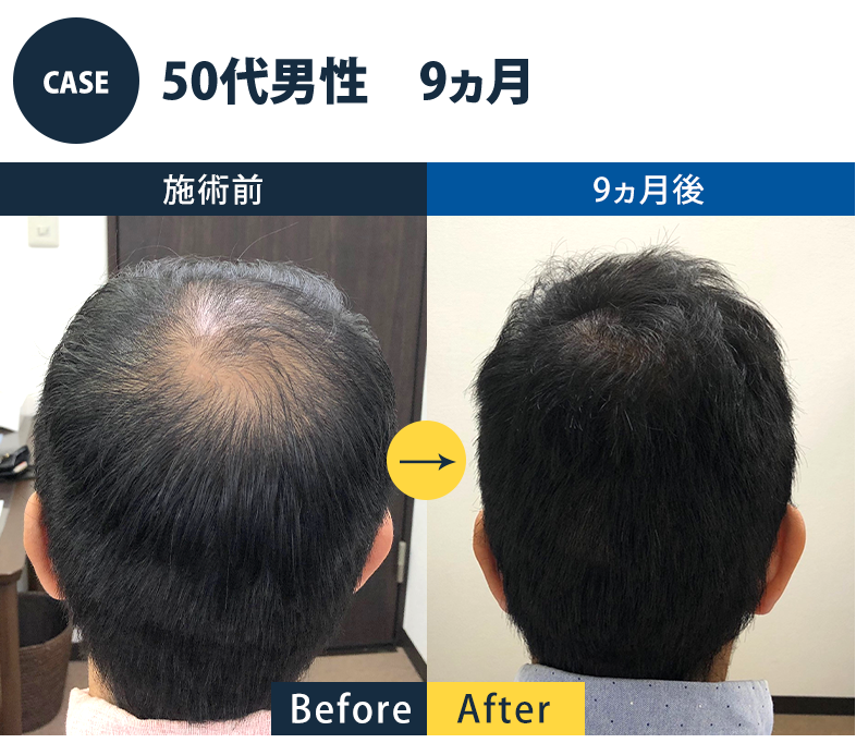 志免町育毛センター改善事例