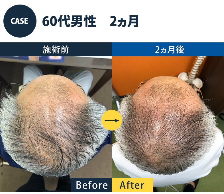 志免町育毛センター改善事例