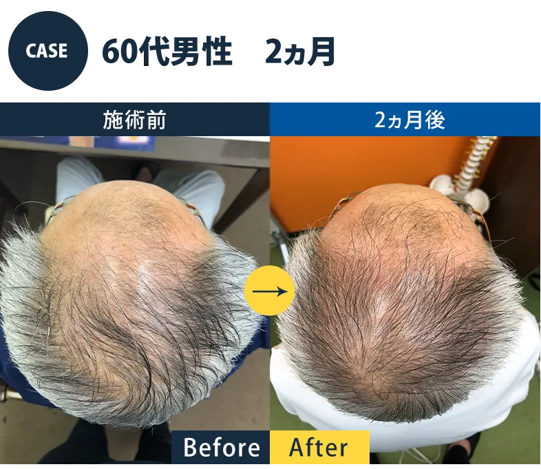 志免町育毛センター改善事例