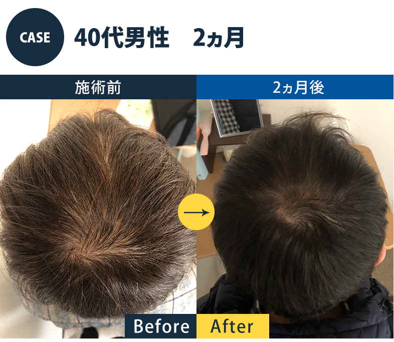 志免町育毛センター改善事例