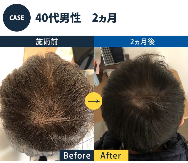 志免町育毛センター改善事例