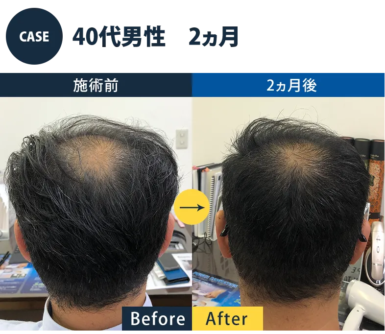 志免町育毛センター改善事例