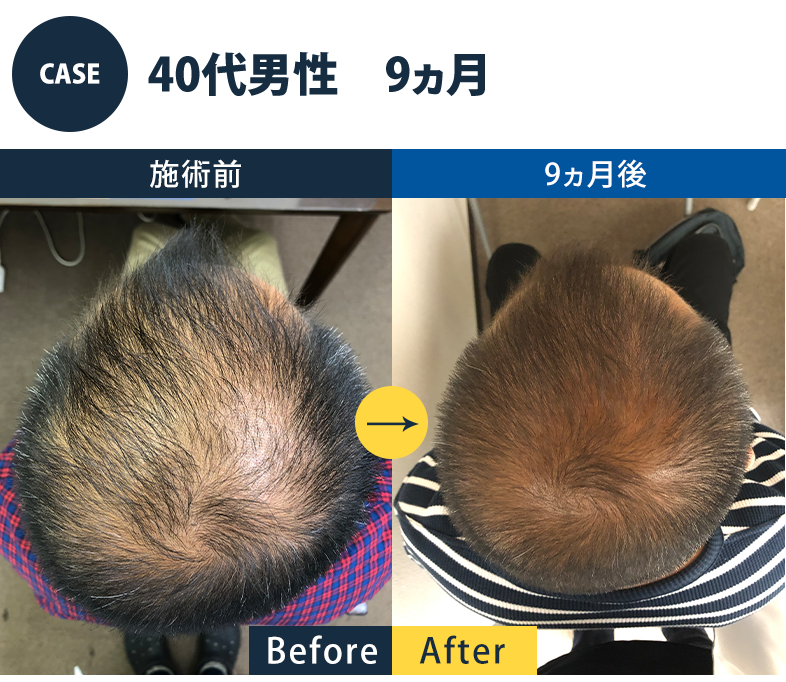 志免町育毛センター改善事例