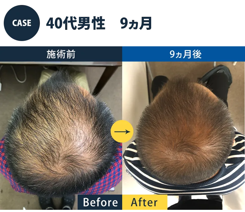 志免町育毛センター改善事例