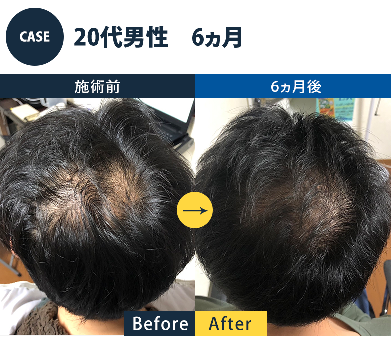 志免町育毛センター改善事例
