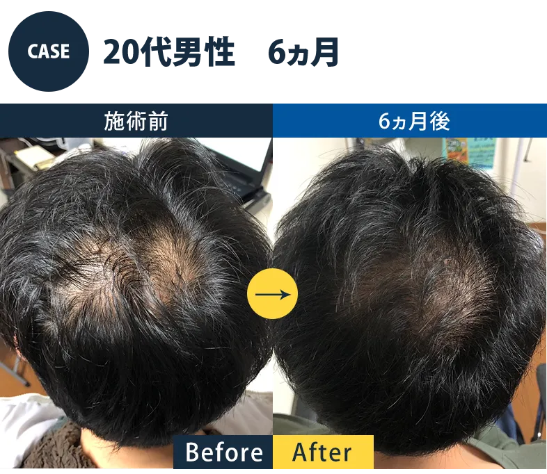 志免町育毛センター改善事例