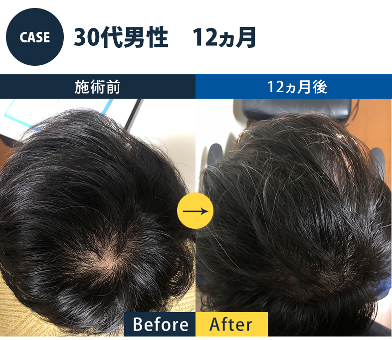 志免町育毛センター改善事例