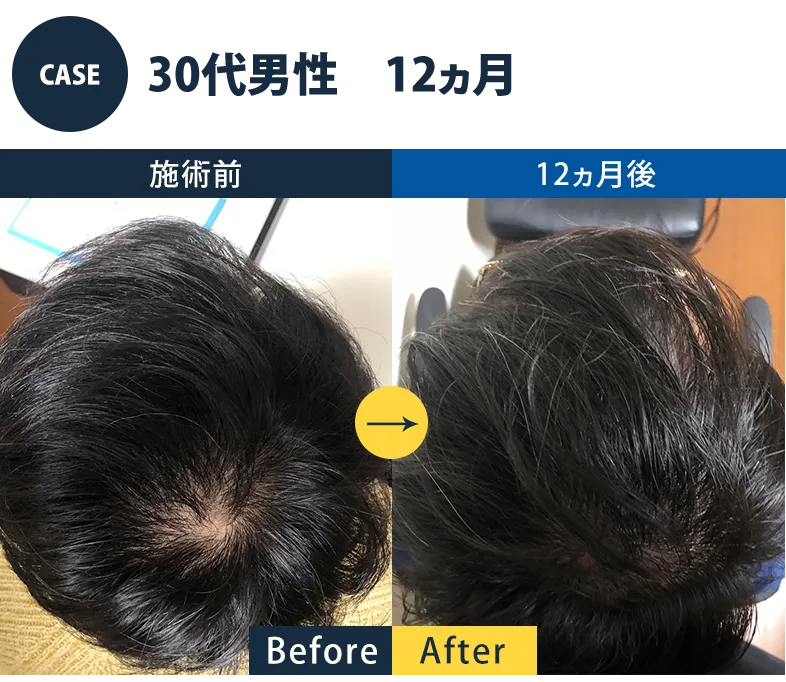 志免町育毛センター改善事例