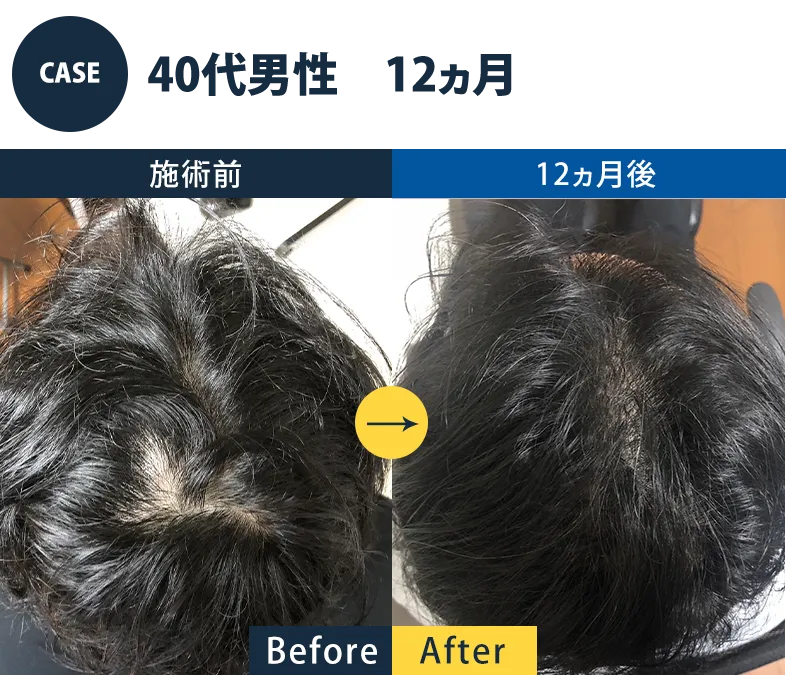 志免町育毛センター改善事例