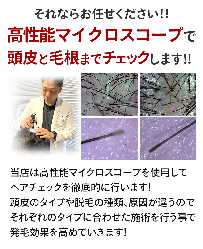 マイクロスコープ