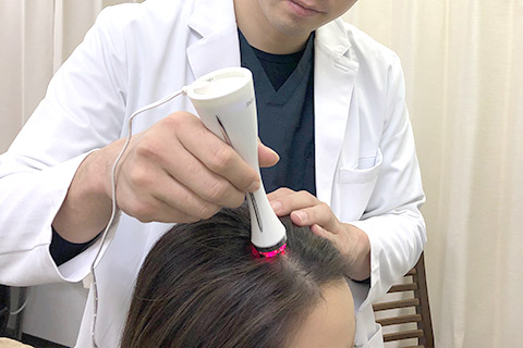 毛根の奥にヒト幹細胞を注入